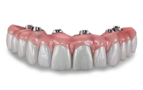 all on 6 dental implants in Cabo San Lucas