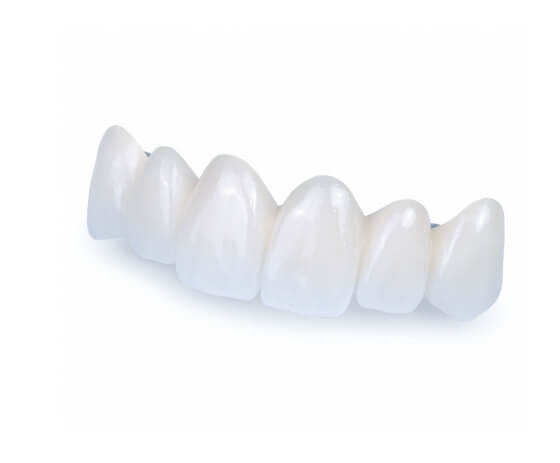 fixed dental bridges available in Cabo San Lucas Mexico