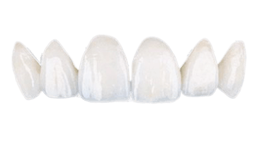 dental veneers in los cabos