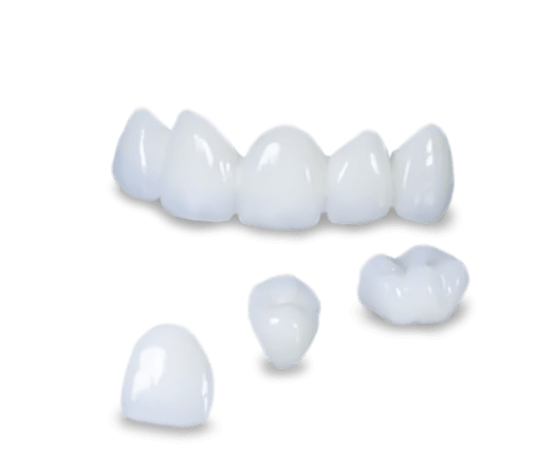 dental crowns and bridges in Mexico