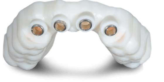 surgical guide for dental implant surgery in Mexico