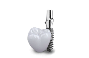 implant-supported dental crowns in cabo san lucas