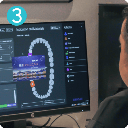 dental technician designing a surgical guide 3D model