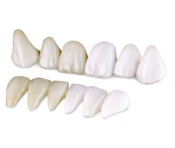 in-office teeth whitening in Los Cabos Mexico