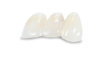 Porcelain crowns in Cabo San Lucas