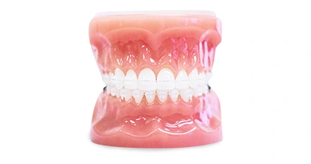 Types of Braces available at Advanced Cabo Dentistry, Los Cabos