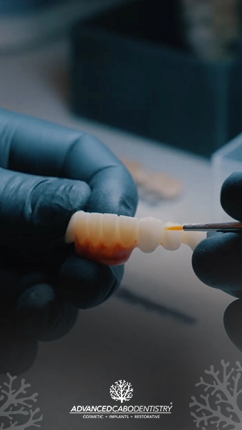 Dental Implant care in Los Cabos cost and how much implants are.