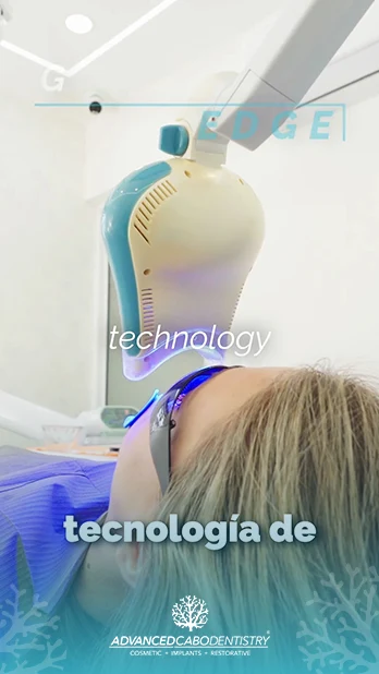 Dental Implant care in Los Cabos cost and how much implants are.