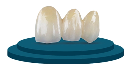 porcelain crowns cost in Advanced Dentistry Cabo