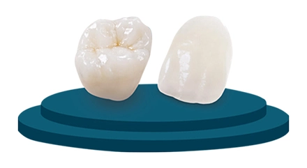 classic crowns cost in Advanced Dentistry Cabo